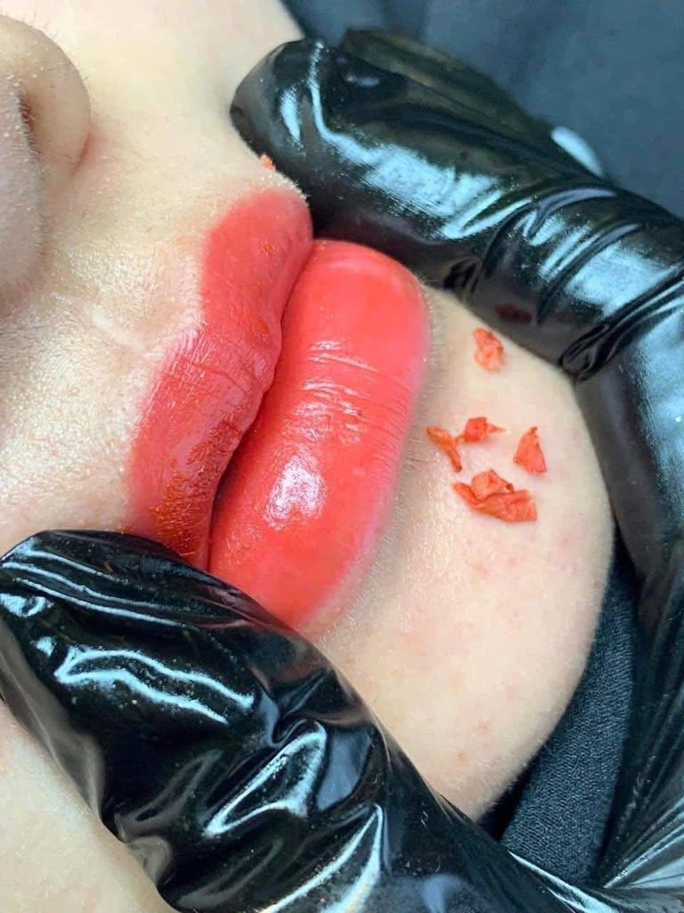 Closeup of bright red glossy lips with black latex gloves framing the face